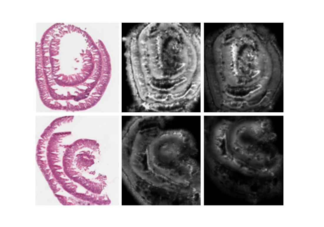 Metabolic imaging of Kras mutant intestinal epithelium