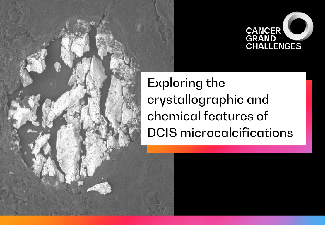 Exploring the crystallographic and chemical features of DCIS microcalcifications