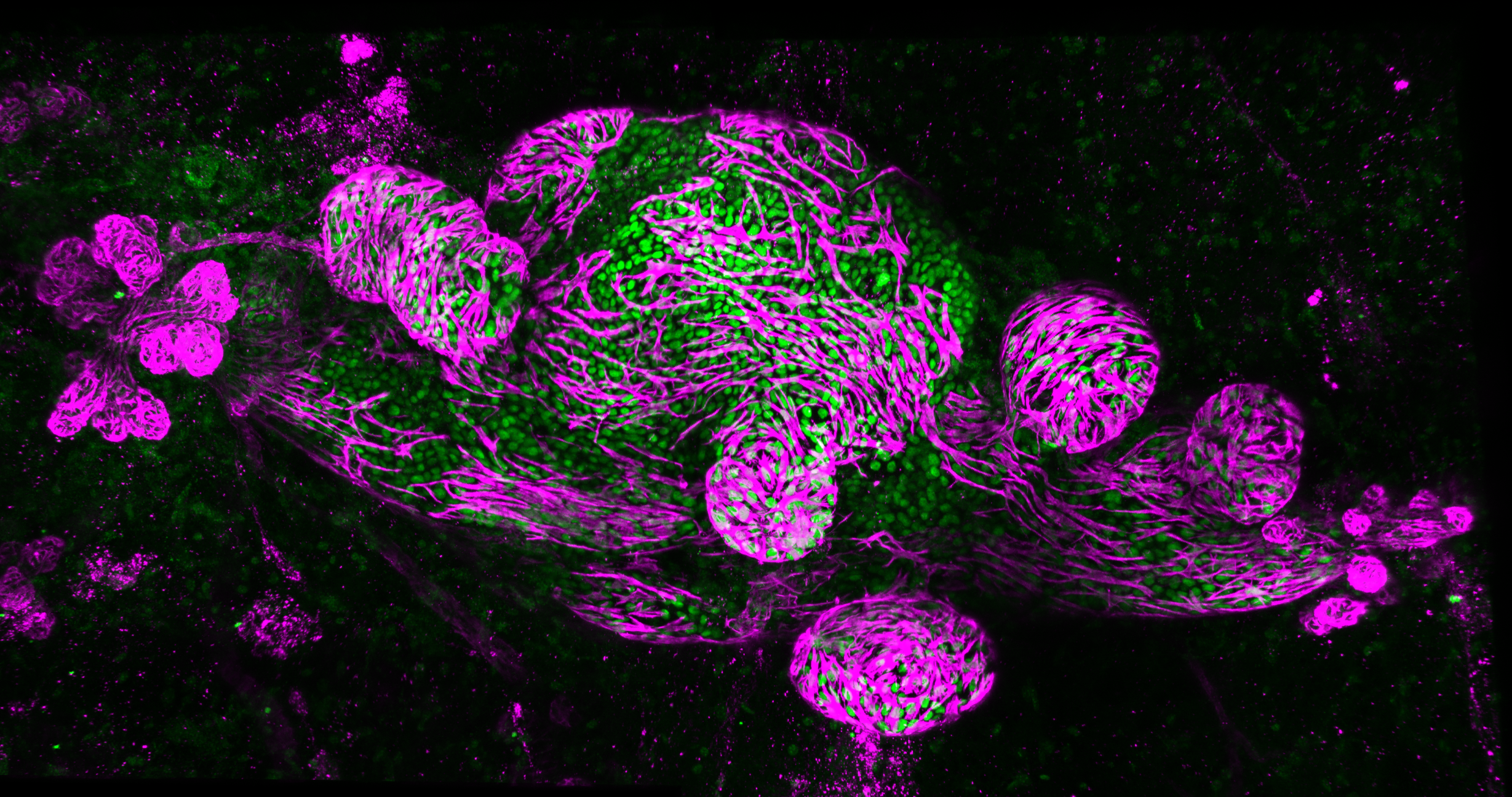 Whole-mount image of DCIS MIND model, with DCIS cells in green and myoepithelial cells in magenta, which represent the ductal tree