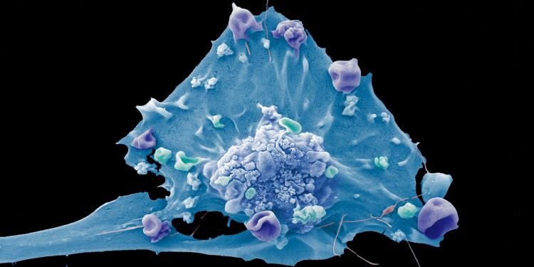 Breast cancer cell_Anne Weston Francis Crick Institute