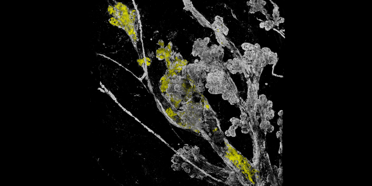 Healthy mammary tissue (ductal structures with sometimes small side branches). The coloured patches are the mutant cells that managed to survive and expand within the healthy tissue