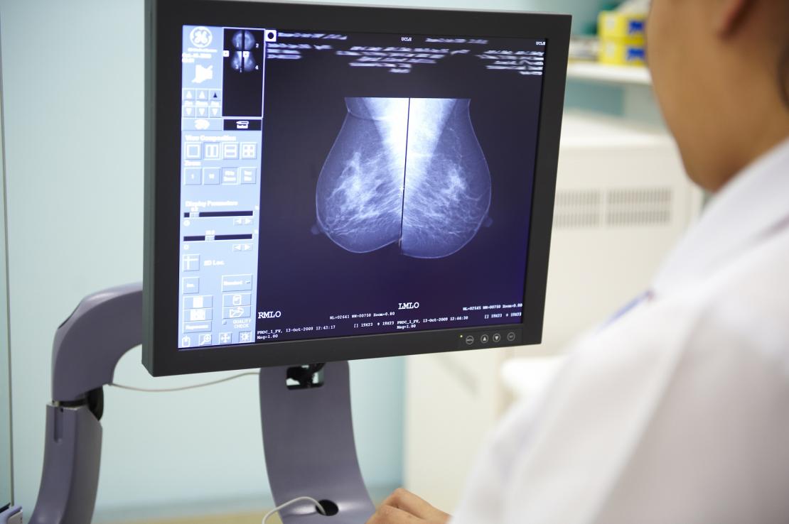 A radiographer examining a mammogram image