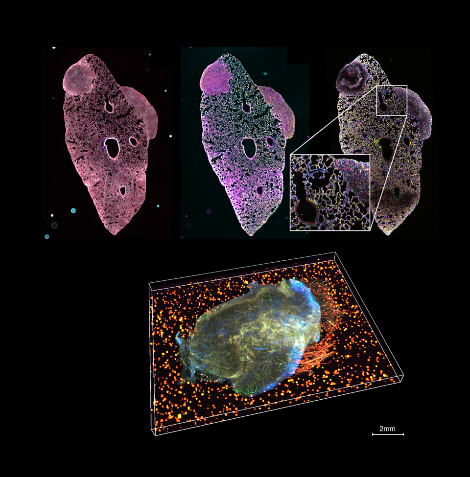 Mutimodal analysis in 3D of a 4T1-derived tumour